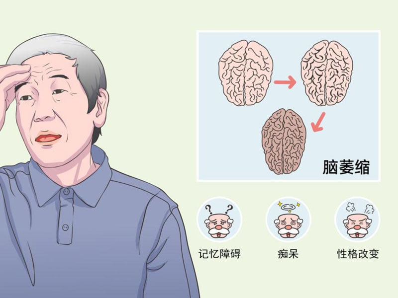 老年痴呆