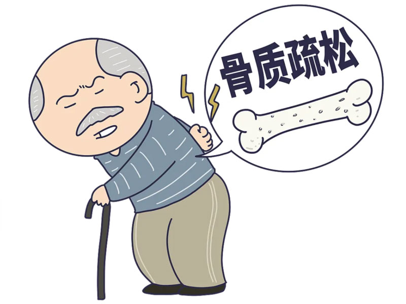 老年健康：骨质疏松症与内分泌变化有关系吗？